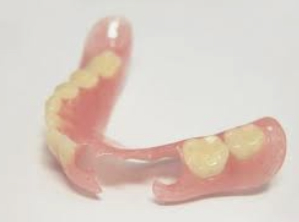 ノンクラスプデンチャーの画像